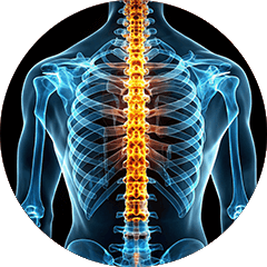 Μέθοδος Schroth sto Ilion petroupoli athina